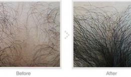 剃阴毛视频,视频教学，轻松掌握私密护理